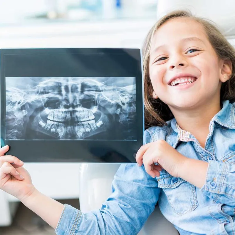Child holding up an x-ray